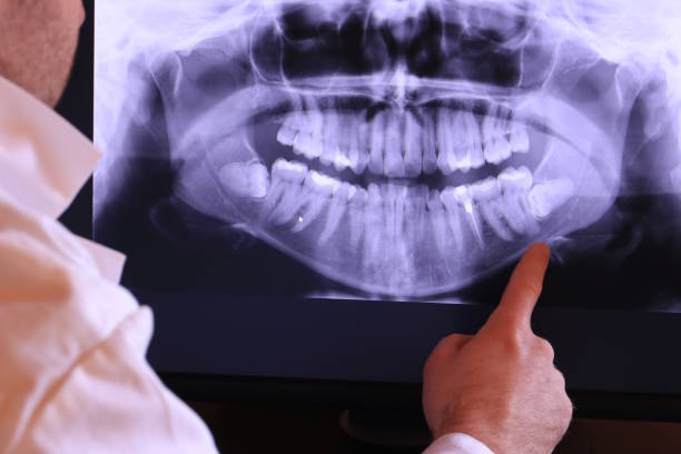 Best Emergency Gum Pain Relief  in West Covina, CA